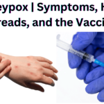 Monkeypox | Symptoms, How It Spreads, and the Vaccine