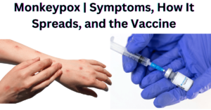 Monkeypox | Symptoms, How It Spreads, and the Vaccine