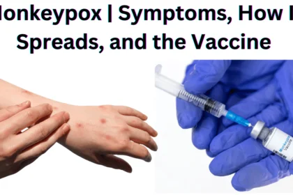 Monkeypox | Symptoms, How It Spreads, and the Vaccine